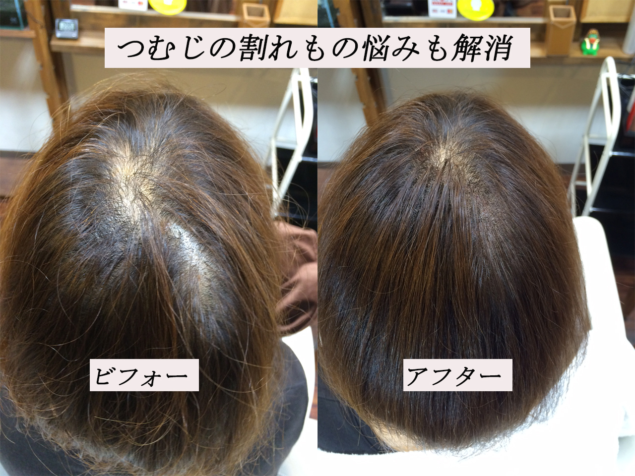 つむじのぱっくり割れも解消 千葉市エクステ増毛 ヘアーサロンever エバー