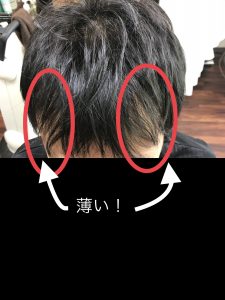 前髪の毛量が少なくて前髪が作れない 千葉市エクステ増毛 ヘアーサロンever エバー