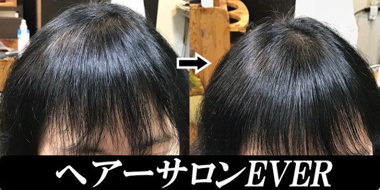 40代女性前髪の増毛 千葉市エクステ増毛ヘアーサロンEVER(エバー)